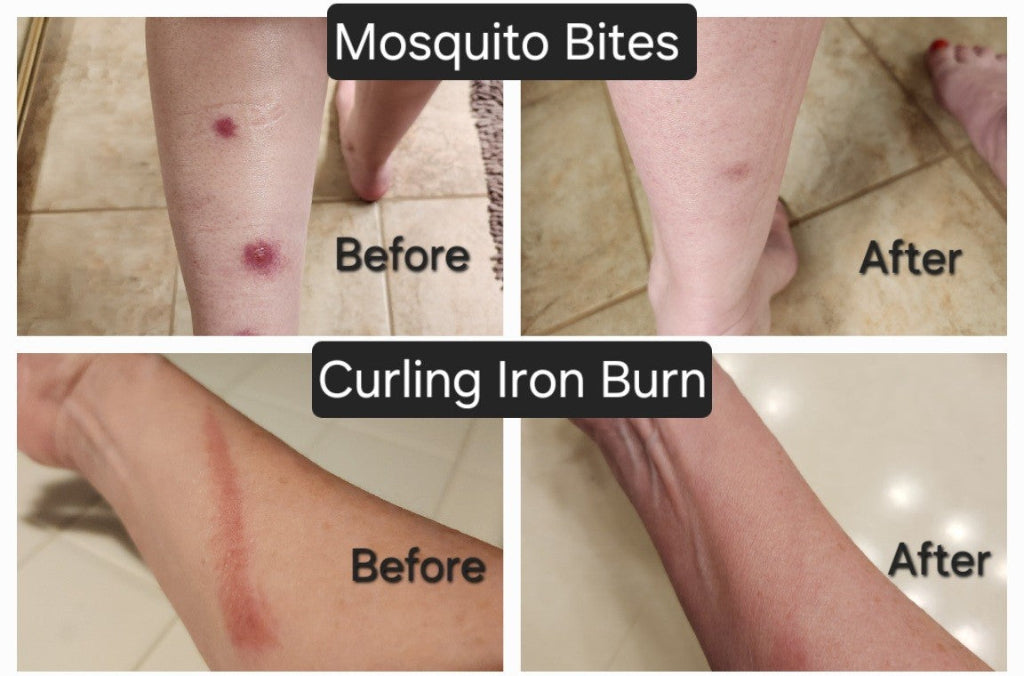 Realizing the Healing Benefits of a Skincare Product